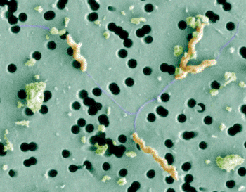 Image: Filter Electron Microscopy of Campylobacter jejuni (Photo courtesy of Louise Salt).